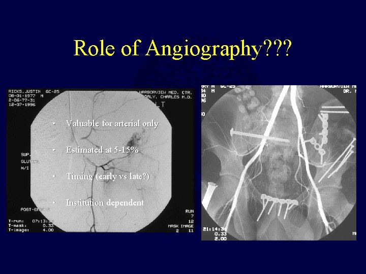 Role of Angiography? ? ? • Valuable for arterial only • Estimated at 5