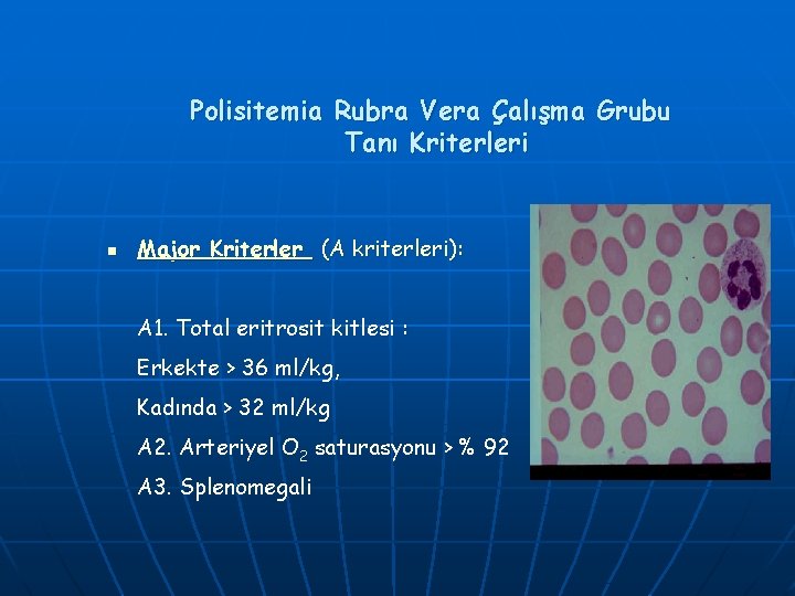 Polisitemia Rubra Vera Çalışma Grubu Tanı Kriterleri n Major Kriterler (A kriterleri): A 1. Polisitemia Rubra Vera Çalışma Grubu Tanı Kriterleri n Major Kriterler (A kriterleri): A 1.