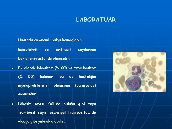 LABORATUAR Hastada en önemli bulgu hemoglobin, hematokrit ve eritrosit sayılarının beklenenin üstünde olmasıdır. n