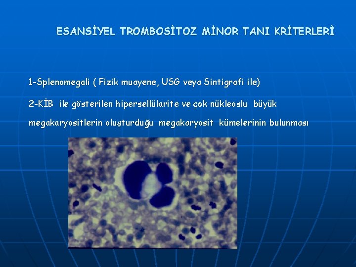 ESANSİYEL TROMBOSİTOZ MİNOR TANI KRİTERLERİ 1 -Splenomegali ( Fizik muayene, USG veya Sintigrafi ile)