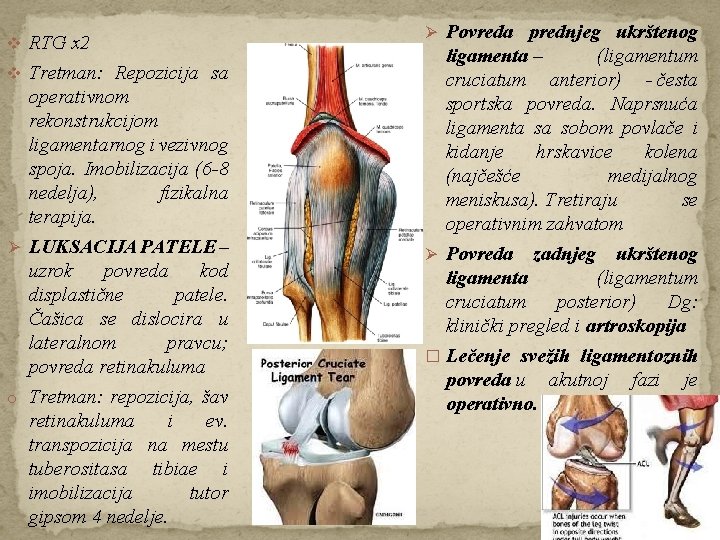 v RTG x 2 v Tretman: Repozicija sa operativnom rekonstrukcijom ligamentarnog i vezivnog spoja.