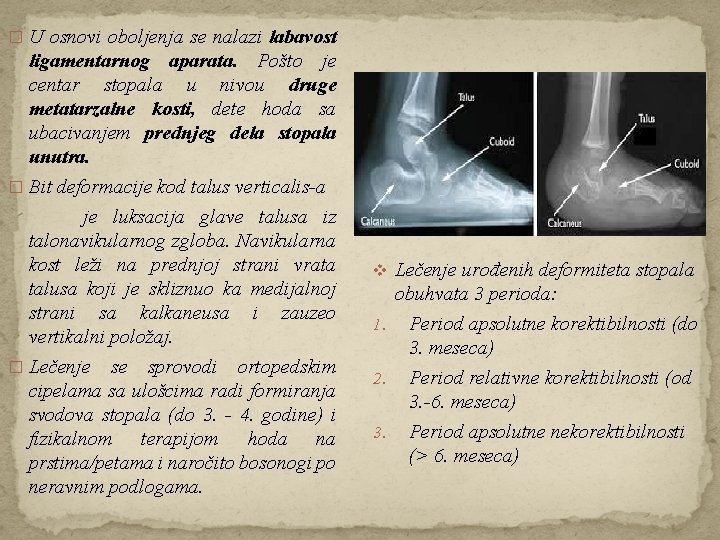 � U osnovi oboljenja se nalazi labavost ligamentarnog aparata. Pošto je centar stopala u