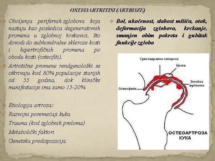 OSTEOARTRITISI (ARTROZE) v Oboljenja perifernih zglobova koja v Bol, ukočenost, slabost mišića, otok, nastaju