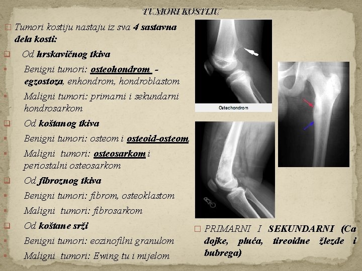 TUMORI KOSTIJU � Tumori kostiju nastaju iz sva 4 sastavna dela kosti: q Od