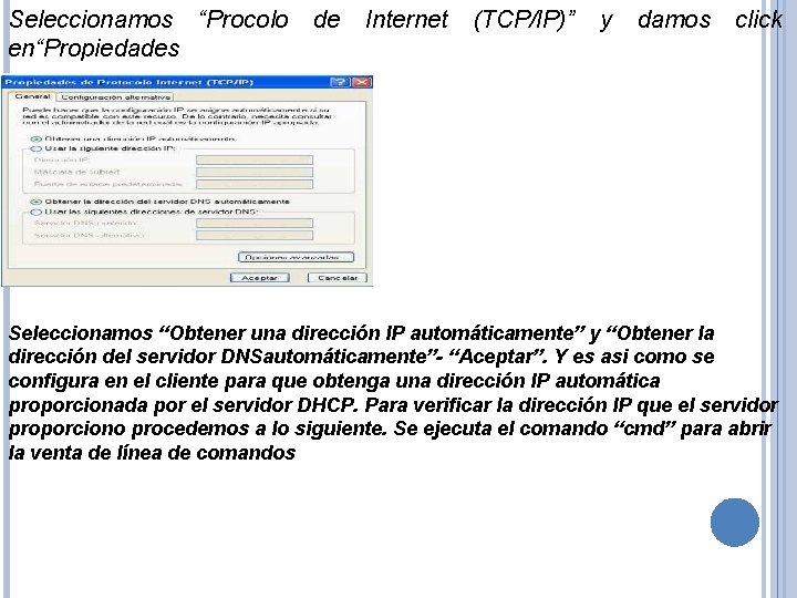 Seleccionamos “Procolo en“Propiedades de Internet (TCP/IP)” y damos click Seleccionamos “Obtener una dirección IP