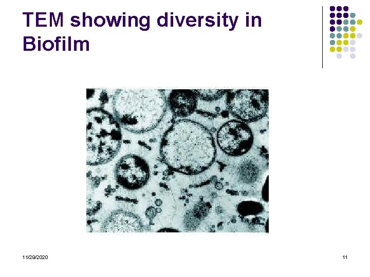TEM showing diversity in Biofilm 11/29/2020 11 