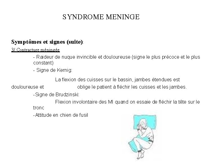 SYNDROME MENINGE Symptômes et signes (suite): 3/ Contracture méningée - Raideur de nuque invincible