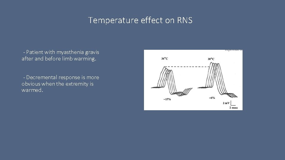 Temperature effect on RNS - Patient with myasthenia gravis after and before limb warming.