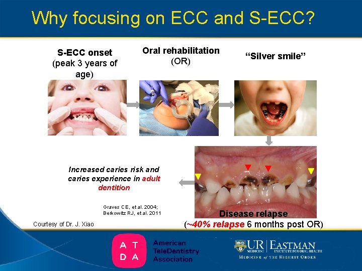 Why focusing on ECC and S-ECC? S-ECC onset (peak 3 years of age) Oral