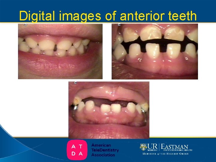 Digital images of anterior teeth 