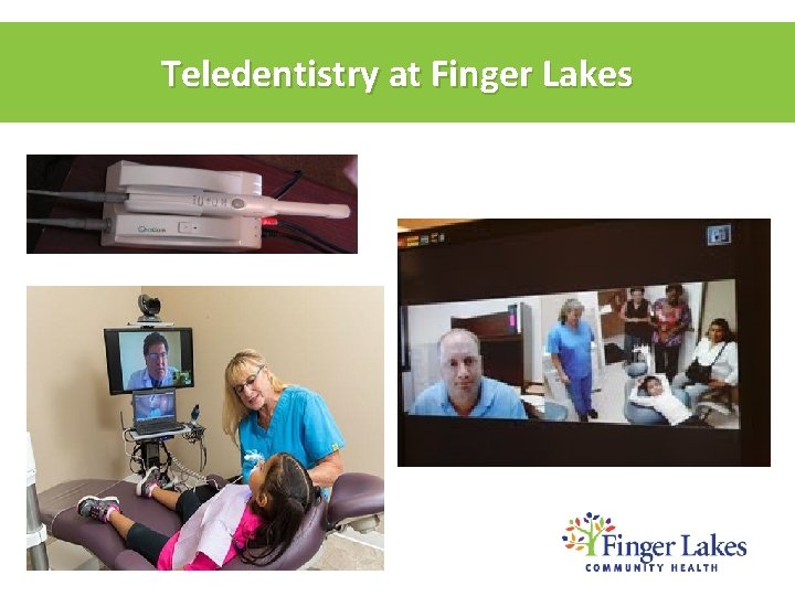 Teledentistry at Finger Lakes 