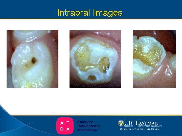Intraoral Images 