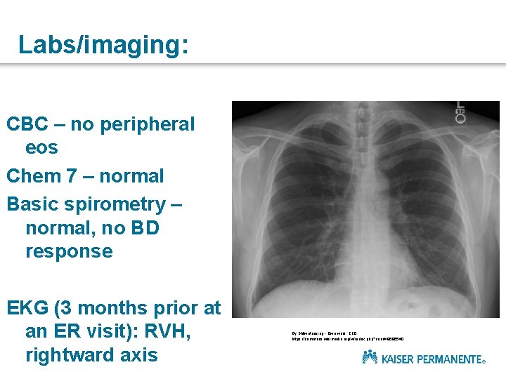Labs/imaging: CBC – no peripheral eos Chem 7 – normal Basic spirometry – normal,
