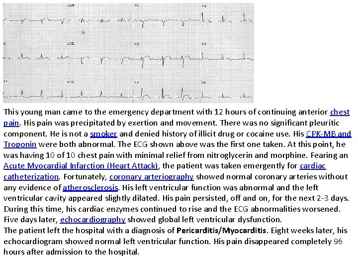 This young man came to the emergency department with 12 hours of continuing anterior