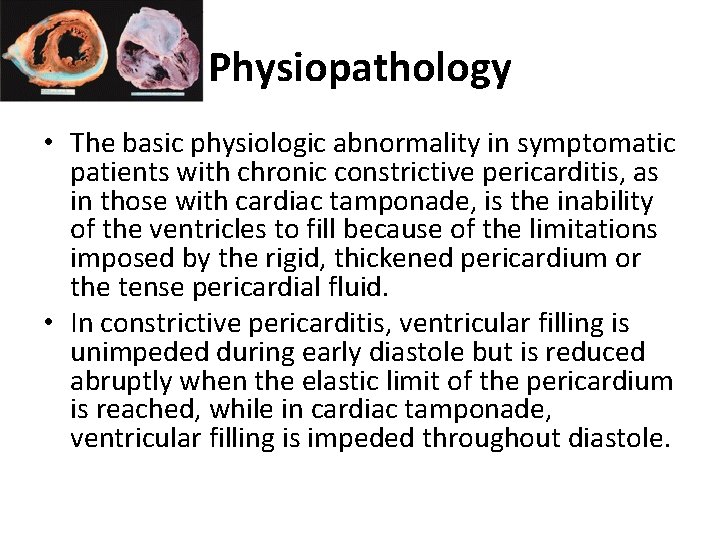 Physiopathology • The basic physiologic abnormality in symptomatic patients with chronic constrictive pericarditis, as