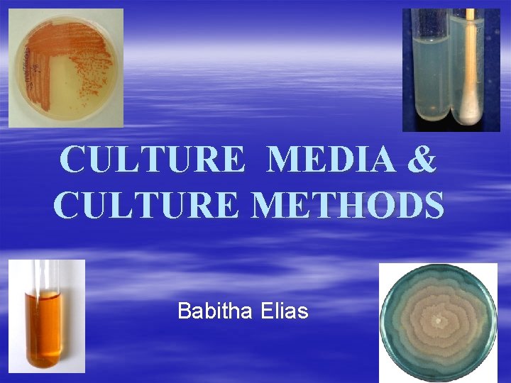 CULTURE MEDIA & CULTURE METHODS Babitha Elias 