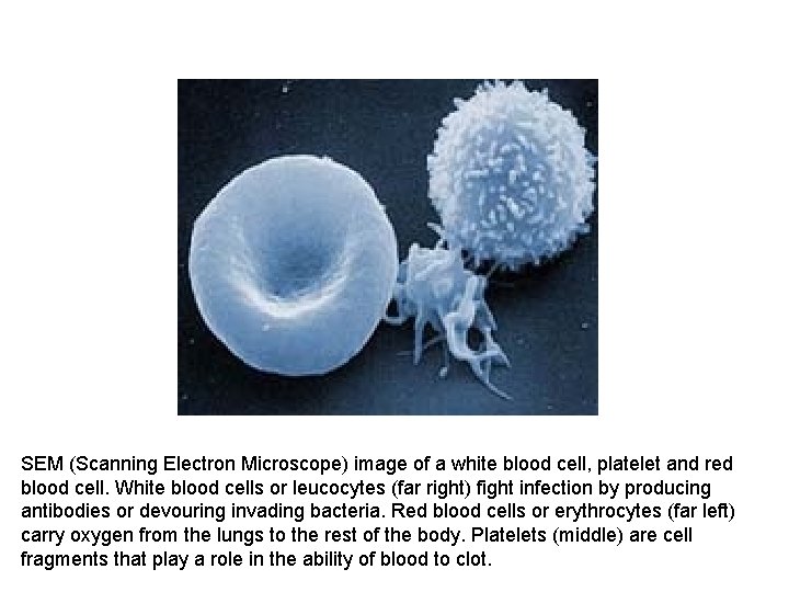 SEM (Scanning Electron Microscope) image of a white blood cell, platelet and red blood