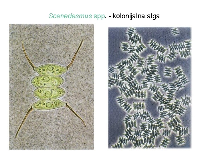 Scenedesmus spp. - kolonijalna alga 