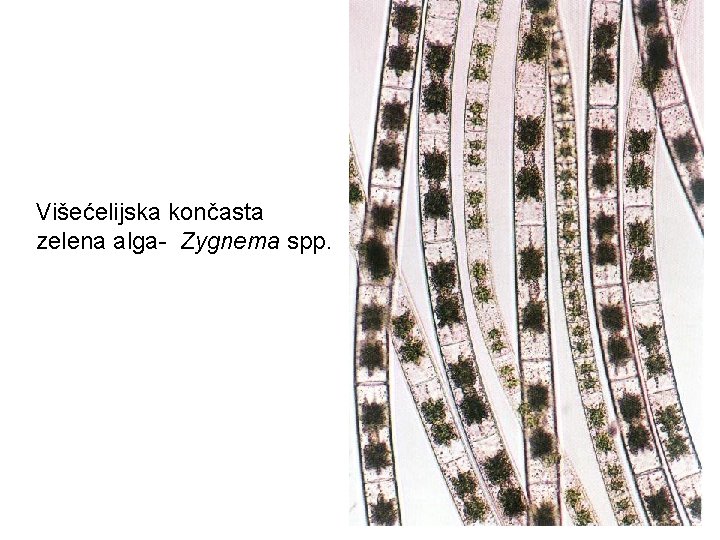 Višećelijska končasta zelena alga- Zygnema spp. 