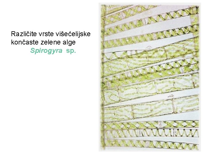 Različite vrste višećelijske končaste zelene alge Spirogyra sp. 