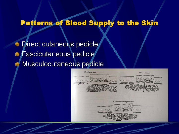 Patterns of Blood Supply to the Skin Direct cutaneous pedicle Fascicutaneous pedicle Musculocutaneous pedicle Patterns of Blood Supply to the Skin Direct cutaneous pedicle Fascicutaneous pedicle Musculocutaneous pedicle