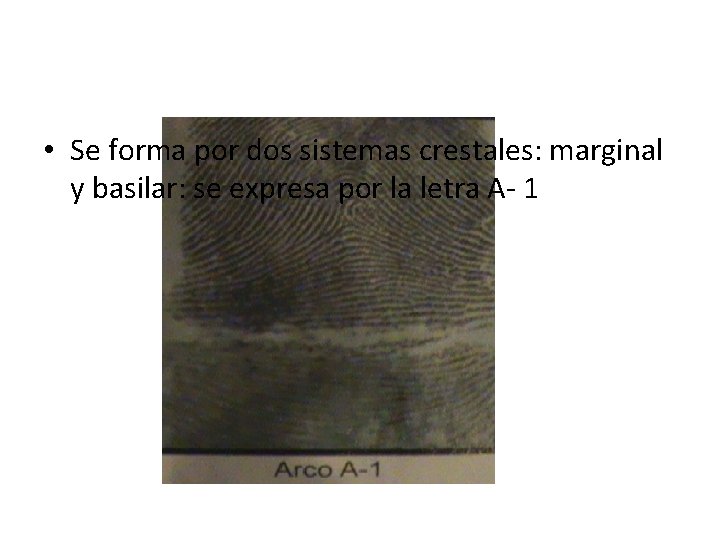  • Se forma por dos sistemas crestales: marginal y basilar: se expresa por