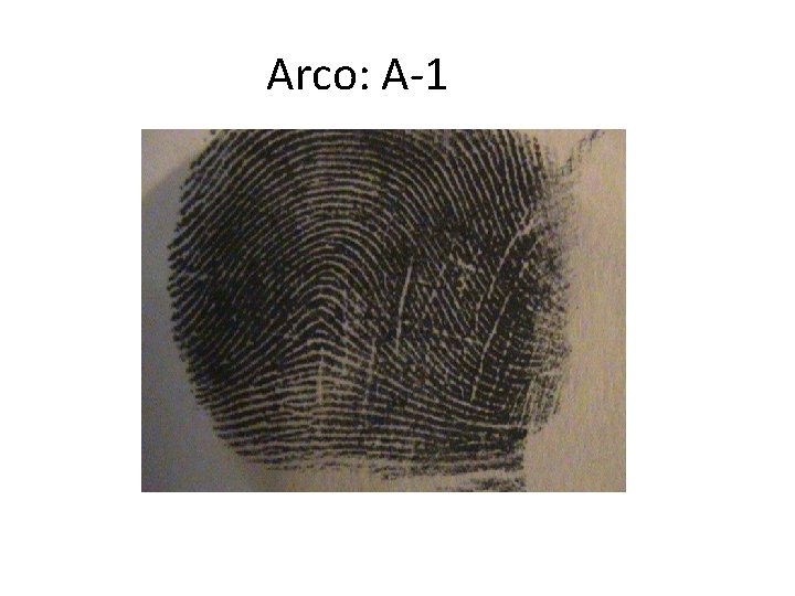 Arco: A-1 