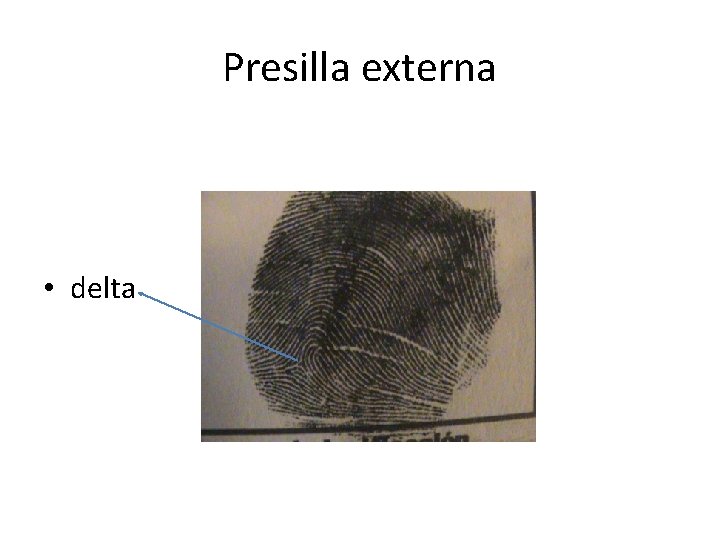 Presilla externa • delta 