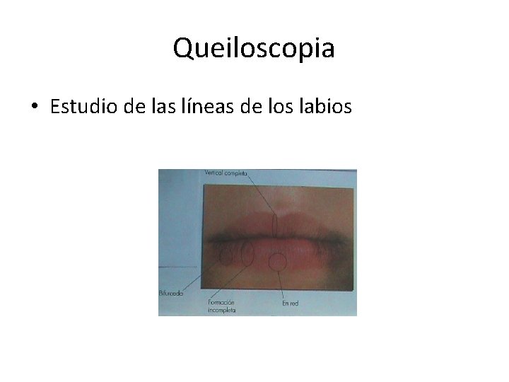Queiloscopia • Estudio de las líneas de los labios 