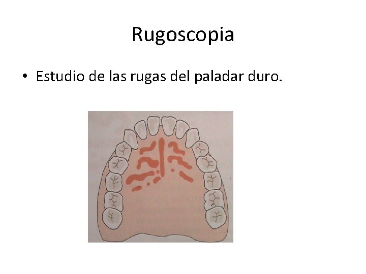 Rugoscopia • Estudio de las rugas del paladar duro. 