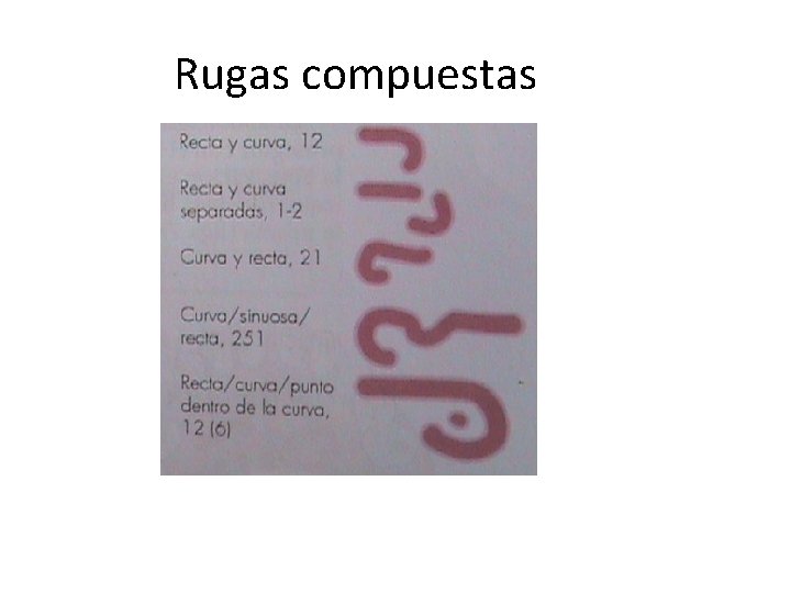 Rugas compuestas 