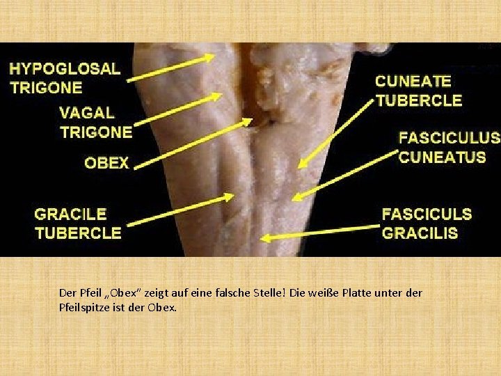 Der Pfeil „Obex” zeigt auf eine falsche Stelle! Die weiße Platte unter der Pfeilspitze