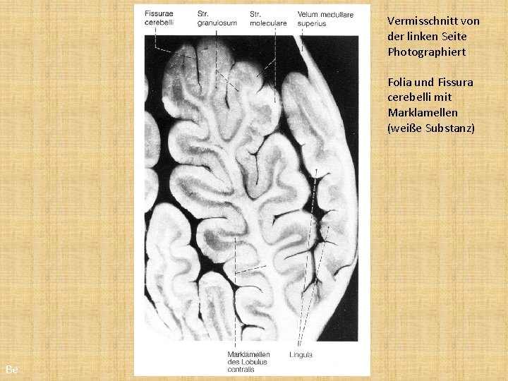 Vermisschnitt von der linken Seite Photographiert Folia und Fissura cerebelli mit Marklamellen (weiße Substanz)