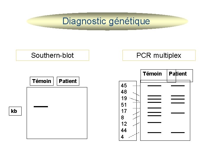 Diagnostic génétique Southern-blot PCR multiplex Témoin kb Patient 45 48 19 51 17 8