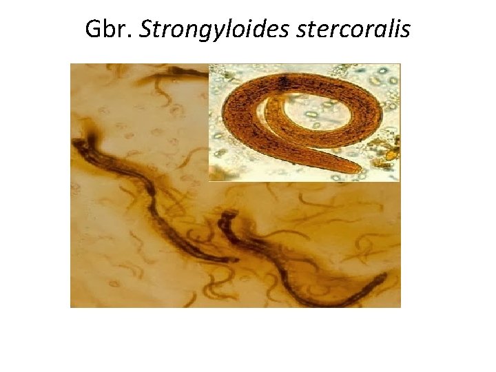 Gbr. Strongyloides stercoralis 