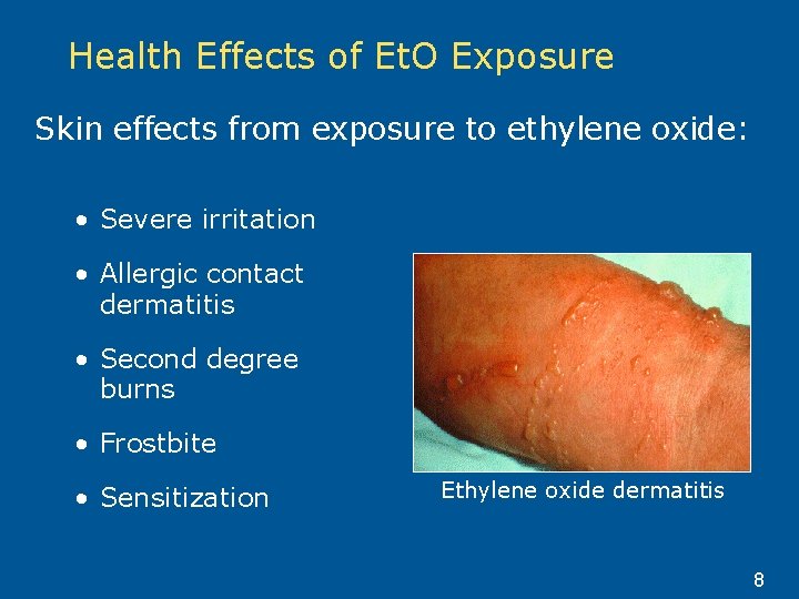 Health Effects of Et. O Exposure Skin effects from exposure to ethylene oxide: •