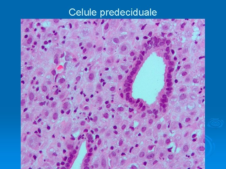 Celule predeciduale 