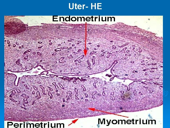 Uter- HE 