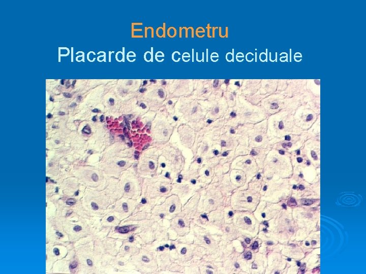 Endometru Placarde de celule deciduale 