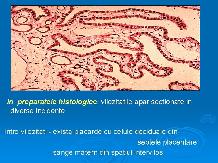 In preparatele histologice, vilozitatile apar sectionate in diverse incidente. Intre vilozitati - exista placarde