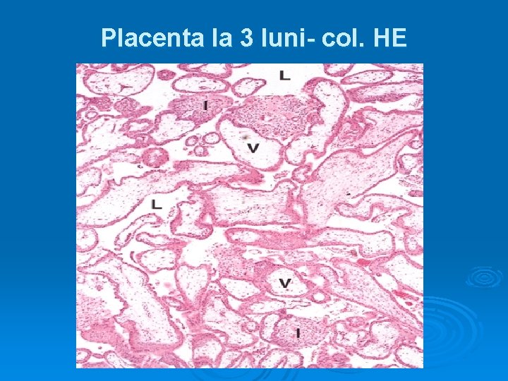 Placenta la 3 luni- col. HE 