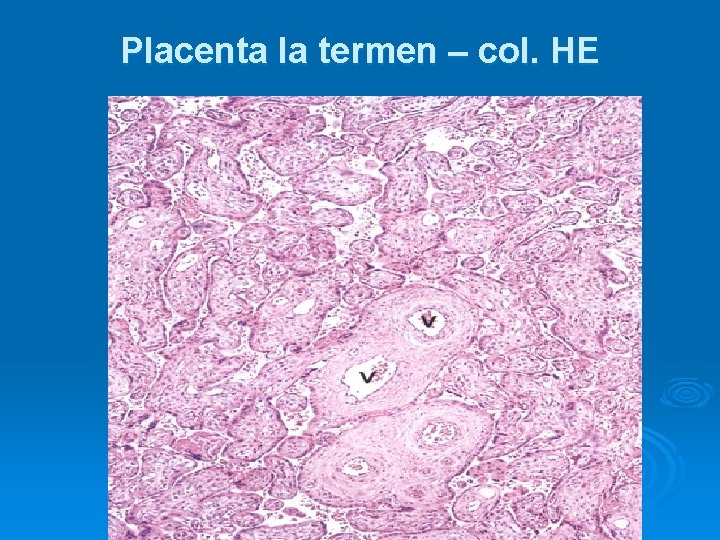 Placenta la termen – col. HE 
