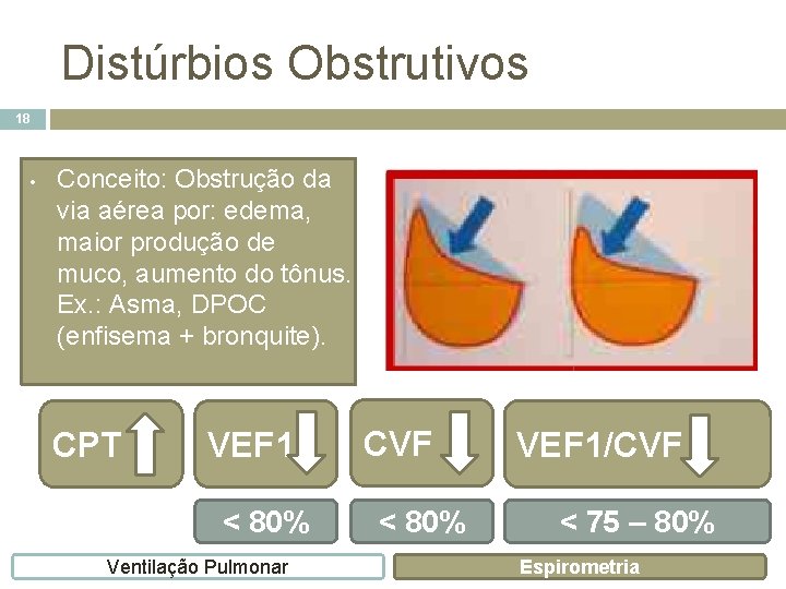 Distúrbios Obstrutivos 18 • Conceito: Obstrução da via aérea por: edema, maior produção de