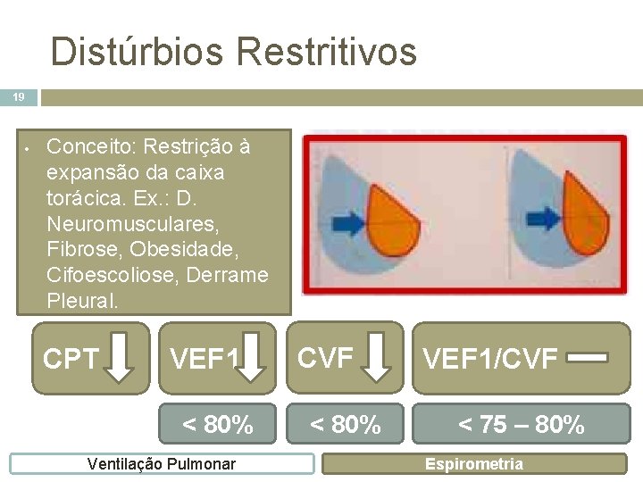 Distúrbios Restritivos 19 • Conceito: Restrição à expansão da caixa torácica. Ex. : D.