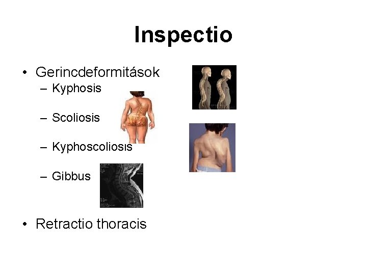 Inspectio • Gerincdeformitások – Kyphosis – Scoliosis – Kyphoscoliosis – Gibbus • Retractio thoracis