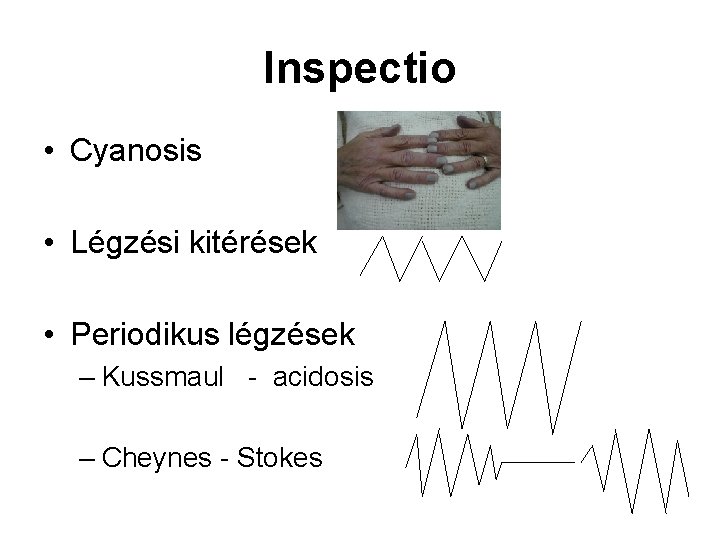 Inspectio • Cyanosis • Légzési kitérések • Periodikus légzések – Kussmaul - acidosis –