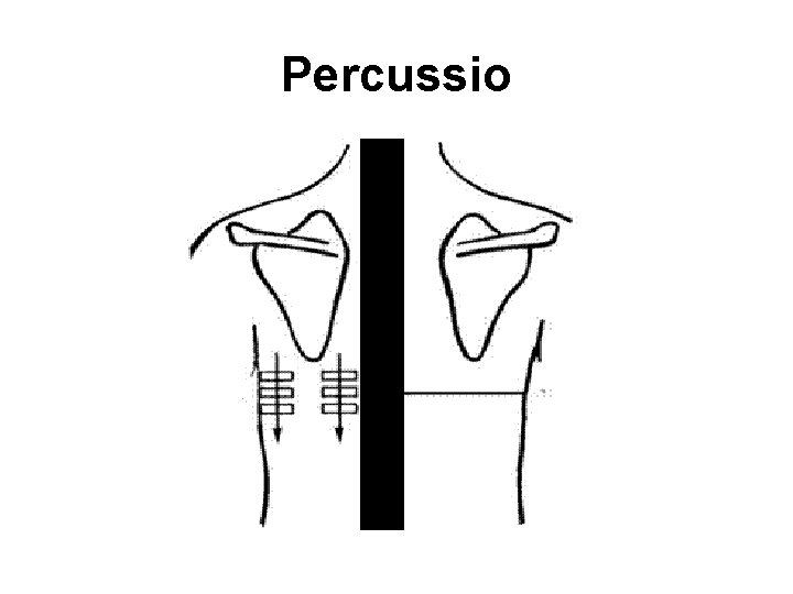 Percussio 