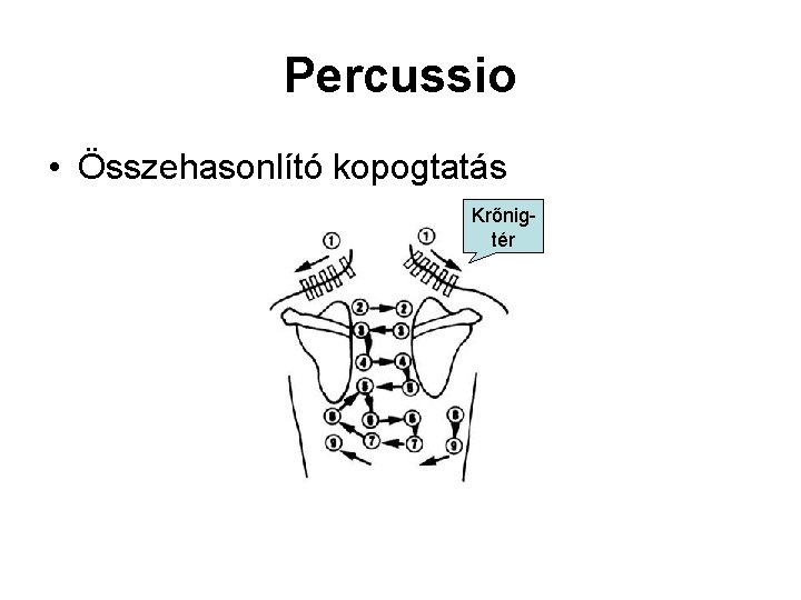 Percussio • Összehasonlító kopogtatás Krőnigtér 