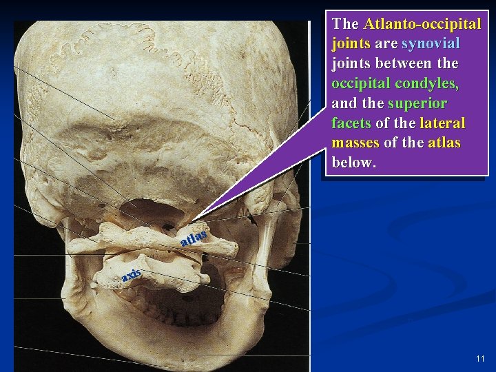The Atlanto-occipital joints are synovial joints between the occipital condyles, and the superior facets