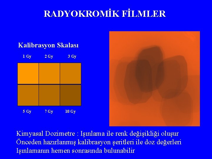 RADYOKROMİK FİLMLER Kalibrasyon Skalası 1 Gy 2 Gy 3 Gy 5 Gy 7 Gy